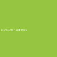 Exorbitante Plastik-Decke