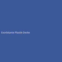 Exorbitante Plastik-Decke