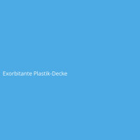 Exorbitante Plastik-Decke